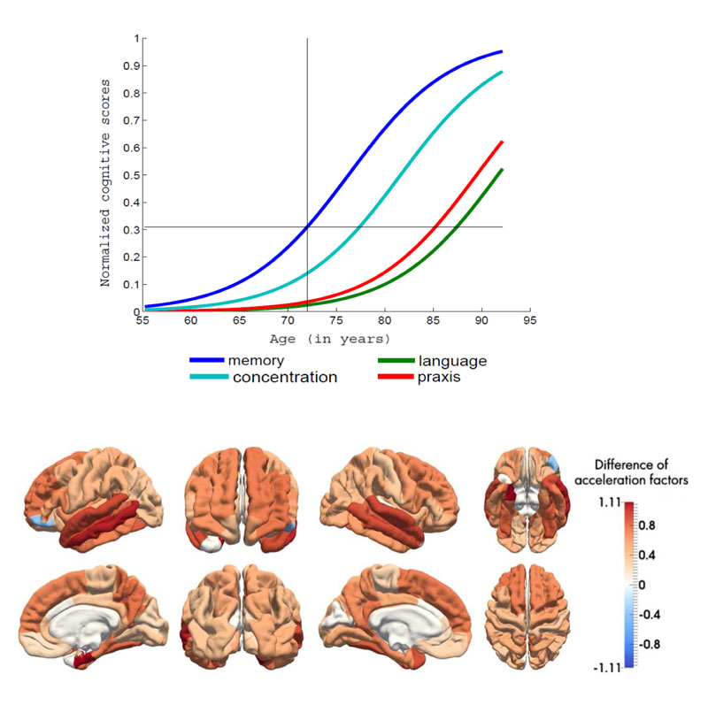 Figure 2: Estimation of disease progression models from a longitudinal dataset of patients with Alzheimer’s disease. Upper panel: average trajectories of data change for a set of cognitive measures. The model allows to infer which types of cognitive deficits occur first. Lower panel: differences of pace of atrophy (extracted from anatomical MRI) between patients with Alzheimer’s disease and healthy controls. This unveils brain regions in which the degenerative process is the more rapid.