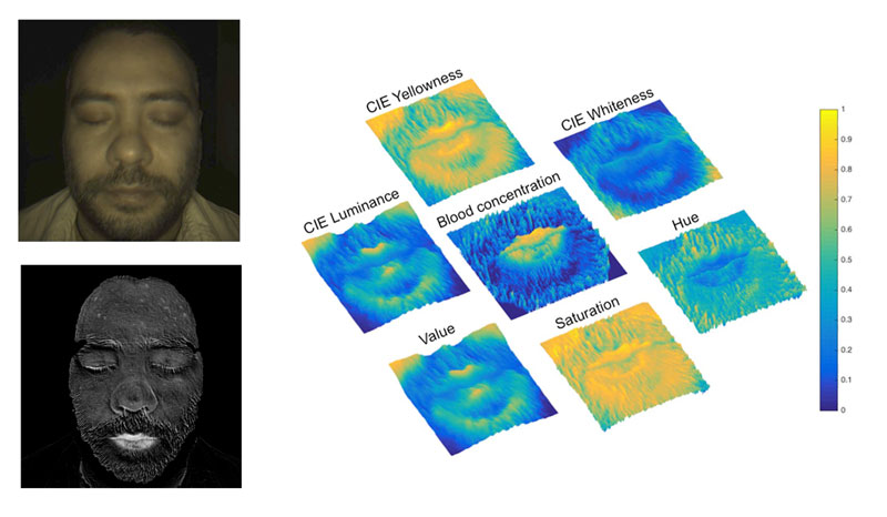 Figure 2: Left: a colour image of a face and the corresponding blood concentration map. Right: comparison of the blood concentration map with colorimetric maps (false colour representation).