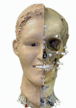Figure 1: Forensic anthropology aims to identify crime victims. The superprojection compares the skull with 2D photographs of missing persons.