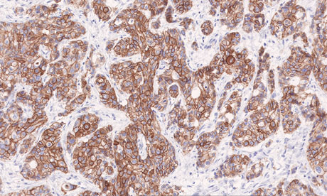  DICOM format image of a pathology slide from a patient's digital health record preserved by ENSURE.  Image by courtesy of Philips Healthcare.