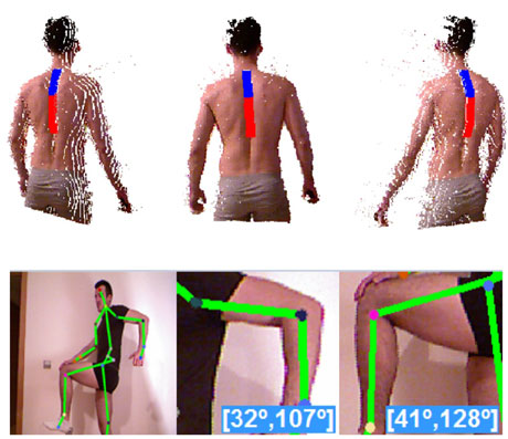 Figure 3: Automatic RGB-Depth analysis of a patient’s spine and the range of movement estimation of different body articulations.