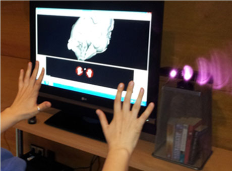 Figure 4: Example of recognized hand poses in a medical volume navigation scenario.