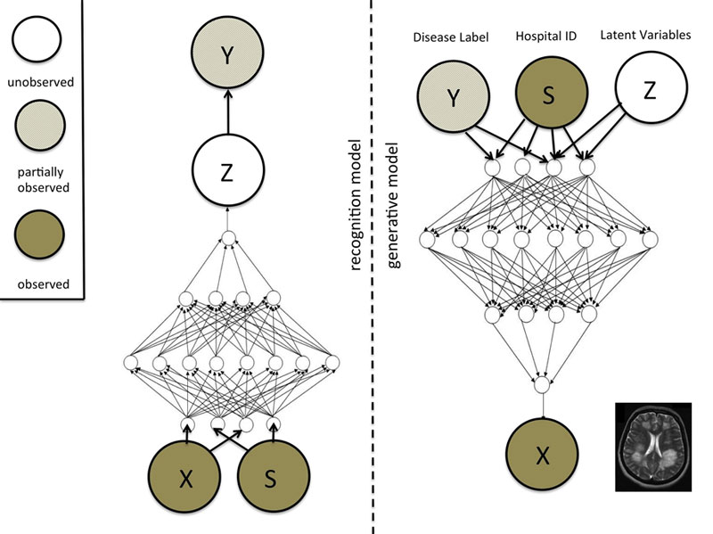 Figure 1: Example of a Variational Auto-encoder model. On the right we have the generative model with three groups of variables at the top: class labels Y, nuisance variables S and latent variables Z. In this example, we may think of Y as disease labels, S as hospital identifiers and Z as size, shape and other relevant properties of a brain. These variables are input to the generative process that generates a pseudo data case; in the example an MRI image of a brain. The discriminative or recognition model on the left takes all the observed variables as input and generates posterior distributions over the latent variables and possibly (if unobserved) the class labels. The models are trained jointly using the variational EM framework. 