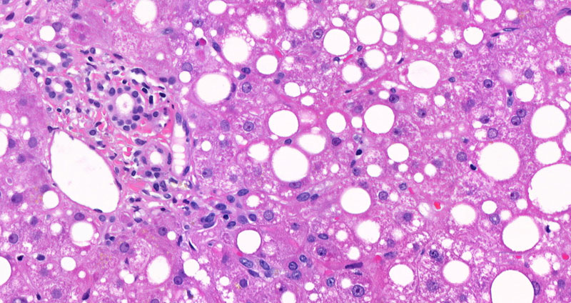 Figure 1: A typical interpretation task in pathology: The (human) pathologist interprets and explains geometrical architectures, shapes, objects, colour, similarity, etc., and produces an explanation – the medical report [1].