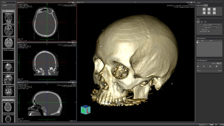 fa treshhold in medinria for mouse brain