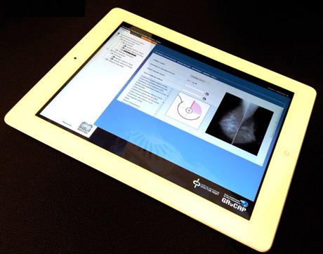 Figure 1: Filling in structured reports for a mammography from a tablet
